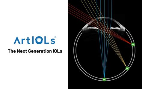 First Inverted Meniscus Optics IOLs By Voptica OBN