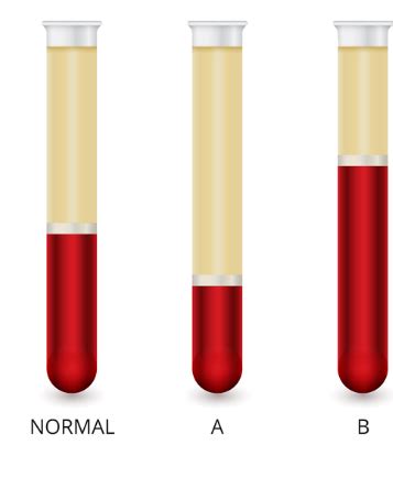 Blood Analysis Techniques Diagram | Quizlet