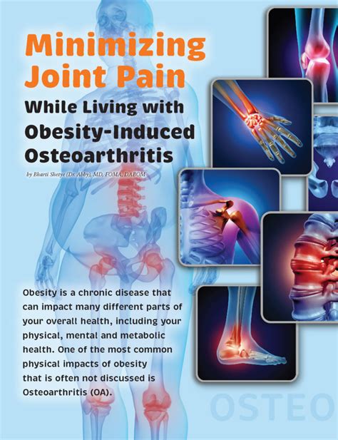 Minimizing Joint Pain While Living with Obesity-Induced Osteoarthritis - Obesity Action Coalition