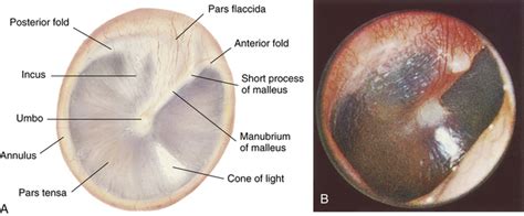 Ear Nose Throat And Mouth Musculoskeletal Key