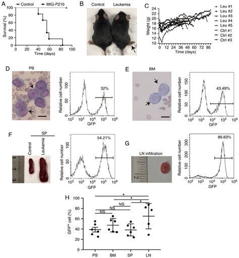 Establishment Of Mouse BCR ABL1 ALL Models A Kaplan Meier Survival