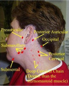 Neck Lymph Node Locations | Nursing assessment, Lymph massage, Lymph nodes