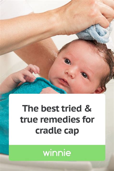 What Is The Best Treatment For Cradle Cap