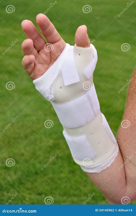 White Arm Brace stock photo. Image of healthcare, wrist - 24145962