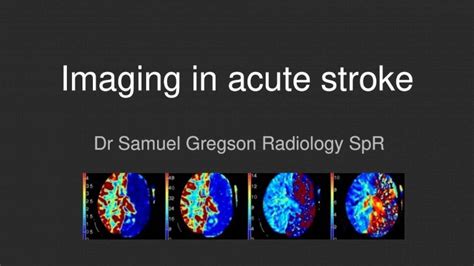 Pdf Imaging In Acute Stroke · 2019 7 4 · First Imaging Modality