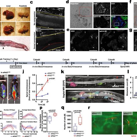 Ephb4 Overexpressing Melanoma Cells Demonstrate Reduced Hematogenous Download Scientific