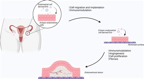 Proposed Role Of Extracellular Vesicles Evs In The Development Of