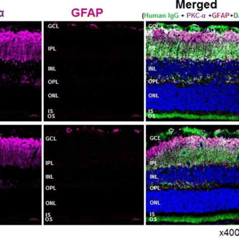 A Immunofluorescence Imaging Of Rat Retina Treated With Patient Serum Download Scientific