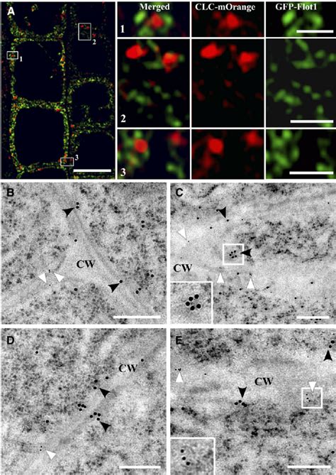 In Vivo Confocal Fluorescence Analysis And Double Immunogold Electron