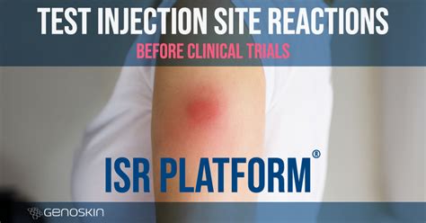 First-in-human injection site reaction platform | Genoskin