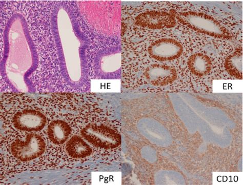 Histological And Immunohistological Examination Of The Excised Specimen