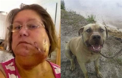 Mujer Fue Atacada En La Cara Por Un Perro Durante Un Ice Bucket