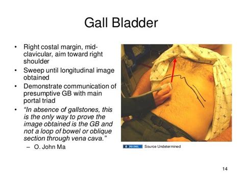 Gemc Right Upper Quadrant Ultrasound Resident Training