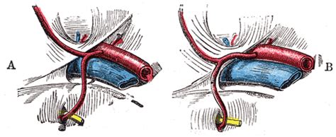 Obturator foramen - wikidoc