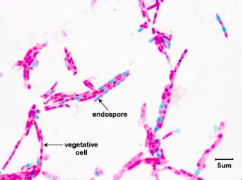 Endospore Stain Procedure Flashcards Quizlet