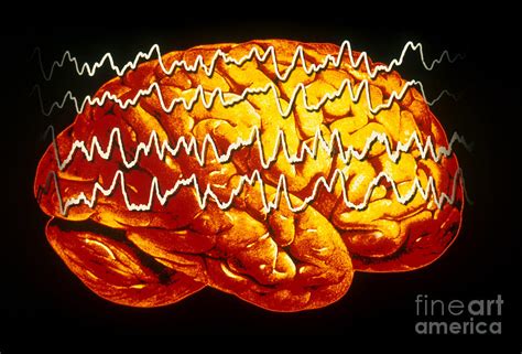 Eeg Of Tonic-clonic Seizure Photograph by Scott Camazine - Pixels