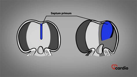 The Formation of the Atria and Venous Return – Icardio