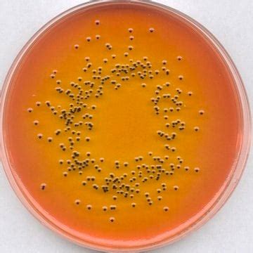 Granucult R Prime Salmonella Shigella Ss Agar Clinisciences