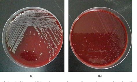 Blood Agar Staphylococcus Aureus