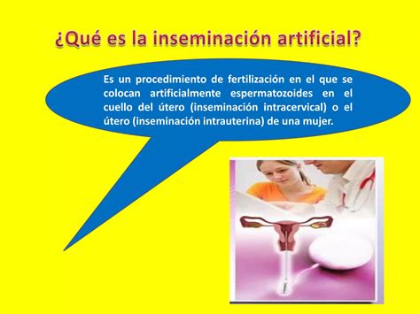 Aip Inseminac Artificial Ppt