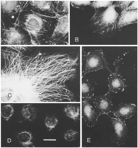 Demonstration Of The Specificity Of Various Antisera To Cytoskeletal