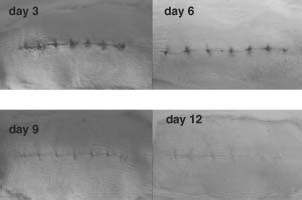 Pictures of incision wound healing at days 3, 6, 9 and 12. | Download ...