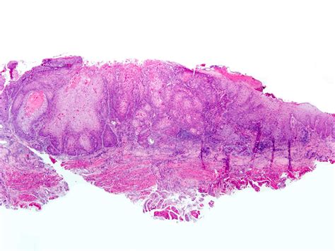 Central Cyanosis Lips Pathology Outlines Infoupdate Org