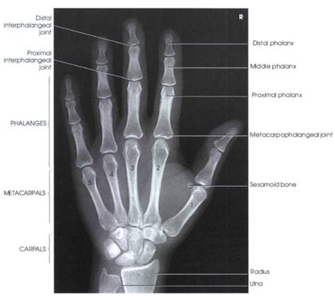 Ortodonti Materiale Optagelse Flashcards Quizlet