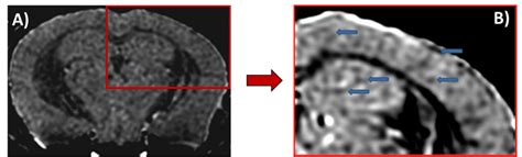 T2*-weighted image of 14-month old APP/PS1 transgenic mice after ... 