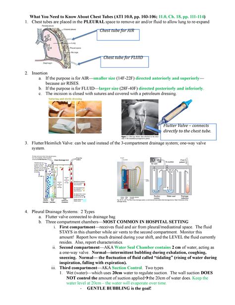 2C Chest Tube Talking Points Th What You Need To Know About Chest