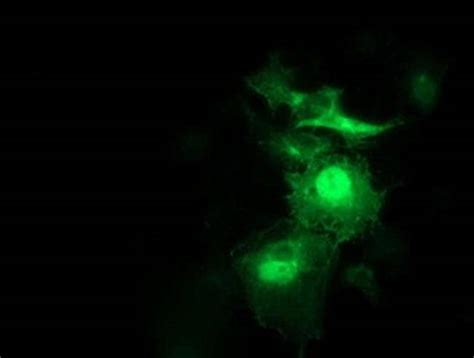 SNAP25 Monoclonal Antibody OTI 1D5 TrueMAB OriGene 30 μL