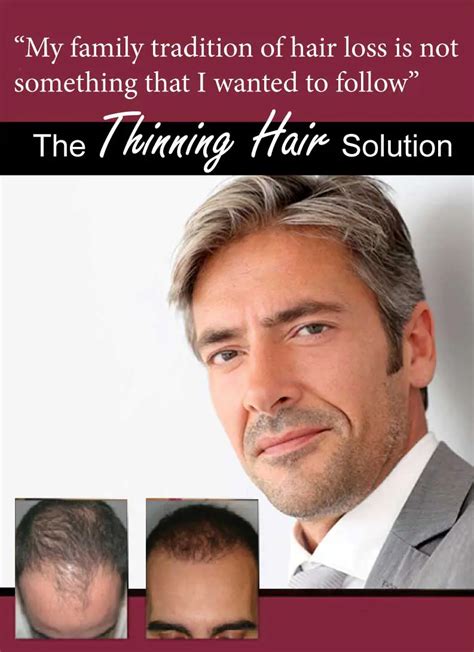 Neograft Automated Hair Transplant System