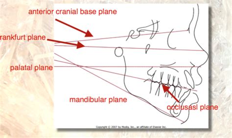 Frankfort Mandibular Plane Angle