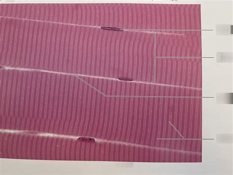 Histology Image Of Skeletal Muscle Striations Diagram Quizlet