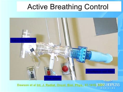 Stereotactic Body Radiation Therapy