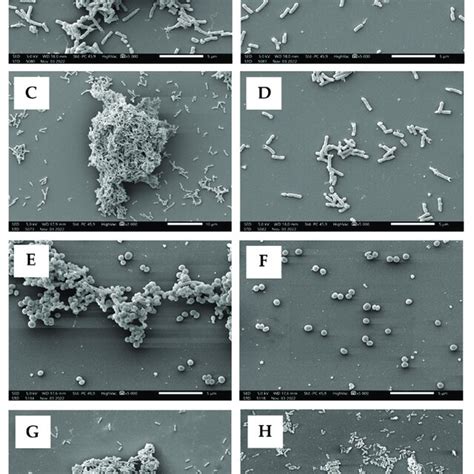 Scanning Electron Microscopy Photographs Of Examined Strains Control