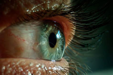 Here's What The Colour Of Your Eye Crust Says About Your Health