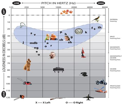 Hearing Loss Chart For Hearing Levels Ponasa