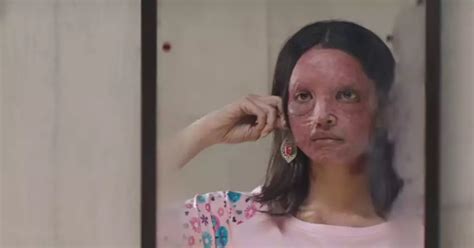 Chhapaak Trailer Review | Filmfare.com