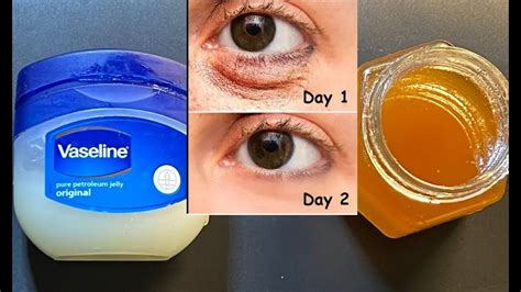 Mix Vaseline With Honey And Get Rid Of Face And Eye Wrinkles Eye