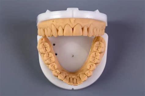 Mold Of Teeth Gypsum Model Plaster Of Teeth Stomatologic Plaster Cast