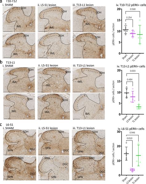 Expression Of Cell Activation Marker PERK In The Dorsal Horn Of The