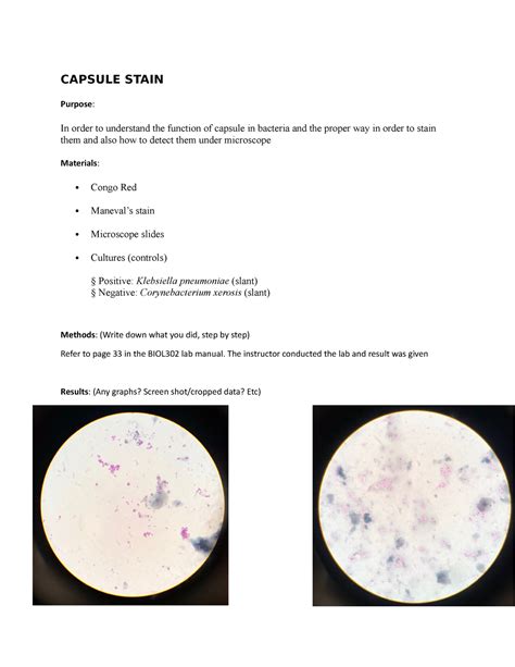 Capsule Stain Capsule Stain Purpose In Order To Understand The