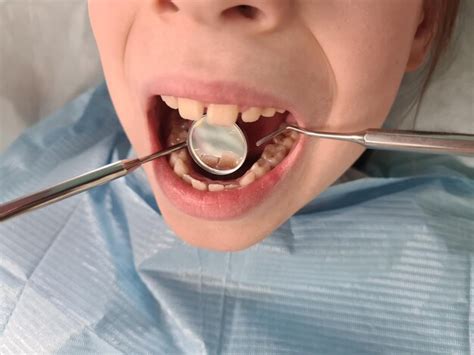 Premium Photo Dentist Doctor Examines Oral Cavity Of Small Patient