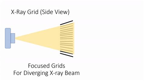 Scatter In X Ray Images How Radiology Works