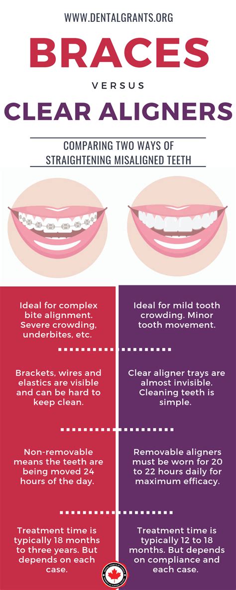 Braces Vs Clear Aligners Learn About The Two Options For Orthodontics