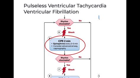 Cardiac arrest part 1 shockable - ACLS 2020 - YouTube