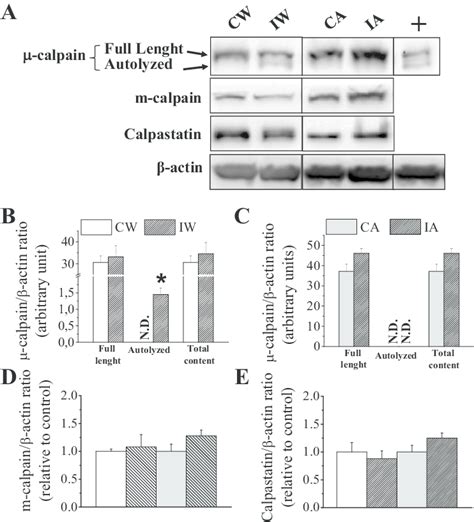 Effects Of Unilateral Hindlimb Immobilization For 10 Days On Protein