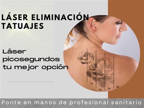 Eliminar Tatuajes Con L Ser Cema Cl Nic Vilanova