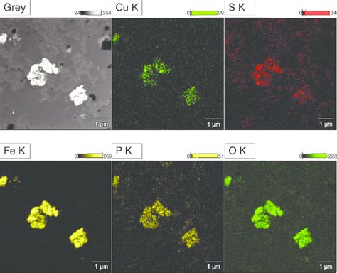 Microanalysis of hepatocytes in ferroportin disease. The... | Download ...